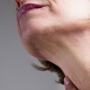 Get your confidence back with a more youthful appearance  after your neck lift surgery.