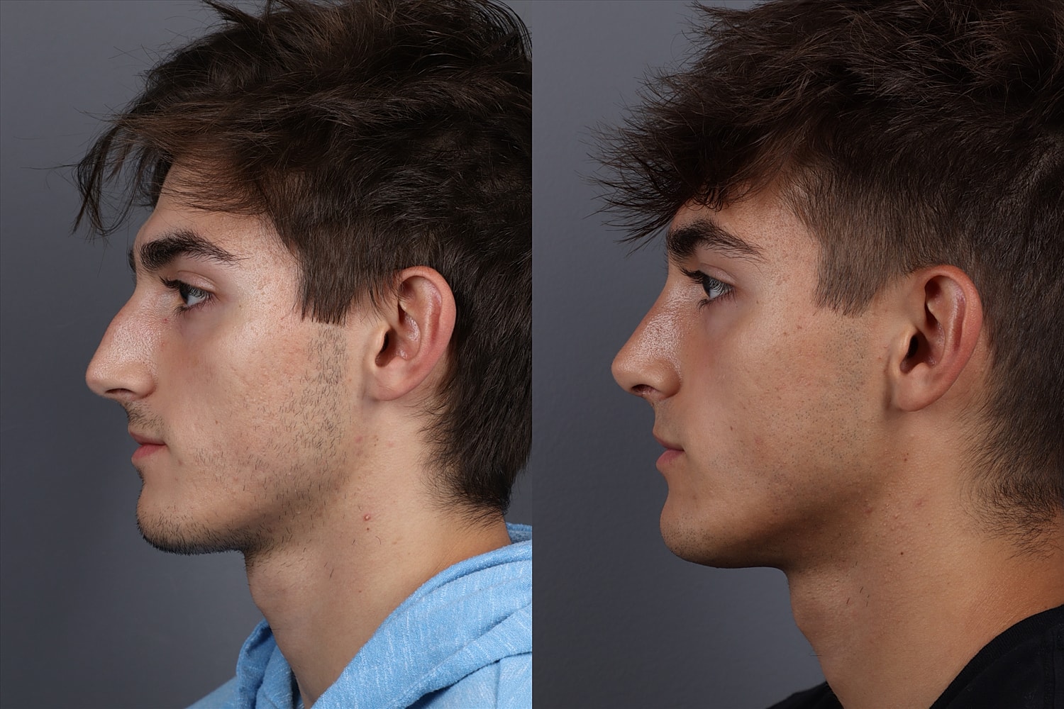 Side profile comparison of two young men.