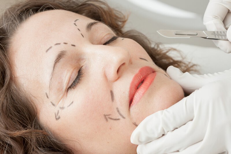 A mini face lift is a less-invasive surgery that can help you look refreshed.