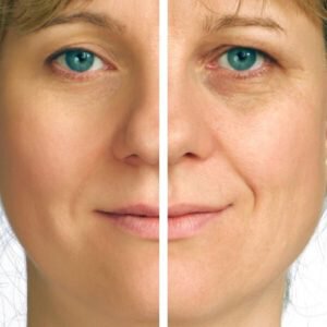 A chronic tired look is a common sign of aging that can be corrected with plastic surgery.