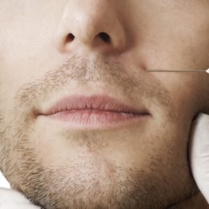 Botox injections are becoming more and more popular among men.