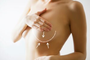 Long Island Breast Augmentation model