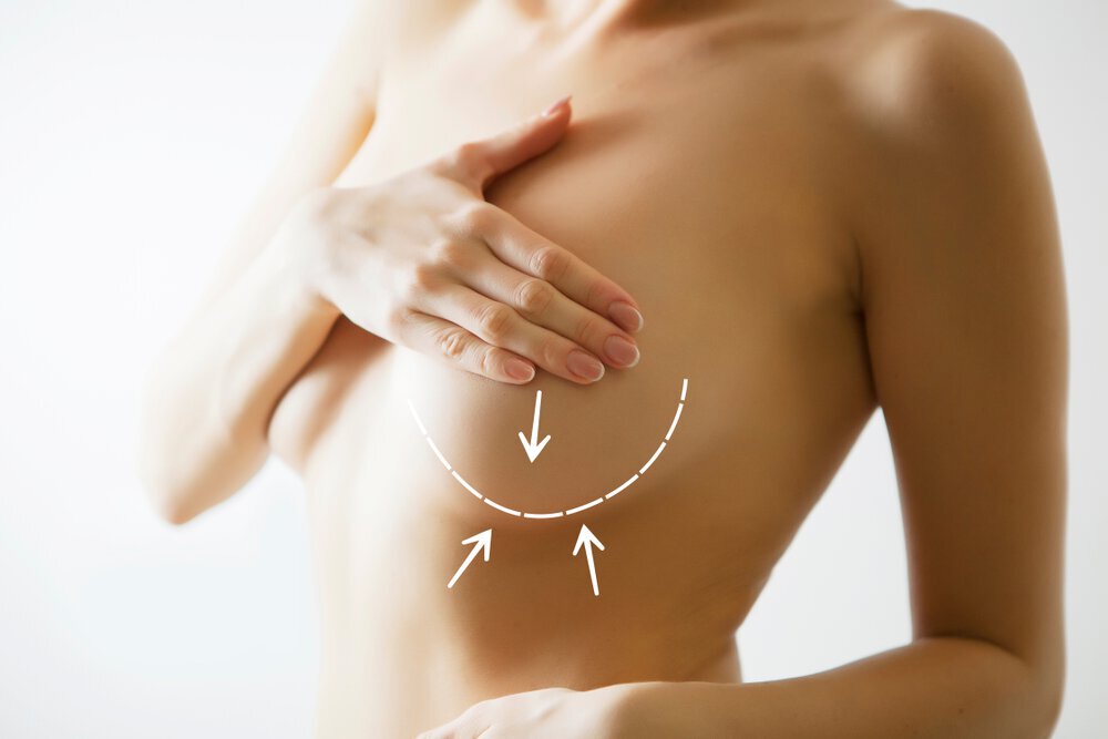 Breast Augmentation myths busted