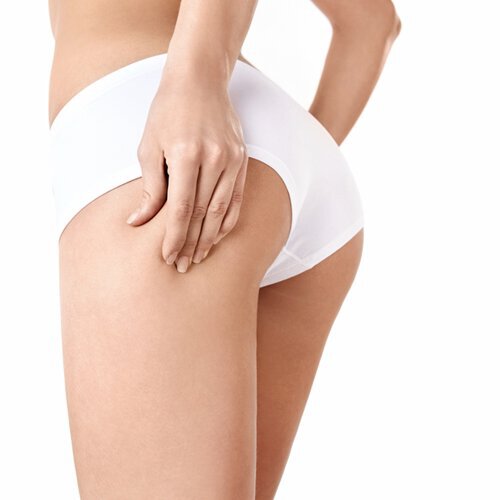 Cellulite doesn't have to be a permanent issue in your life.