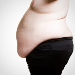 Liposuction can remove excess fat.